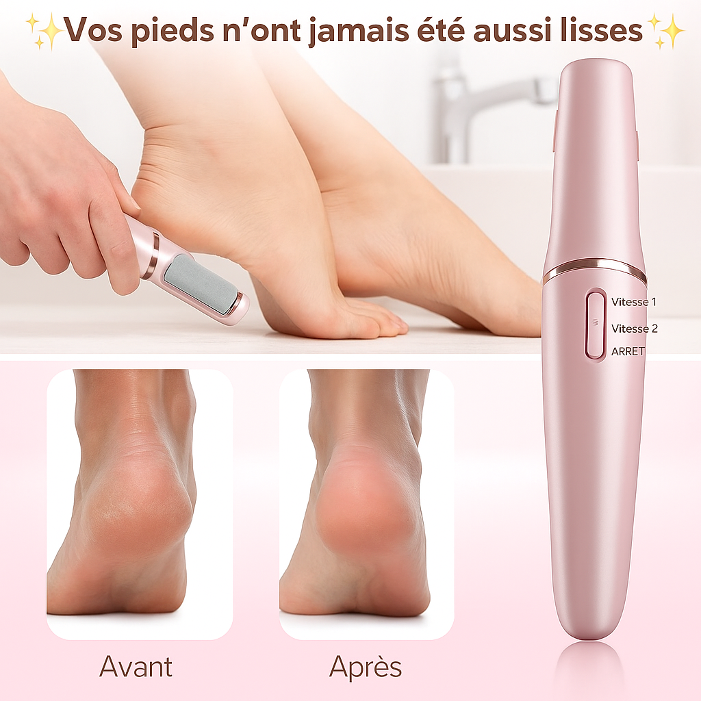 Râpe Électrique Anti-Callosités – Pour des pieds doux comme jamais